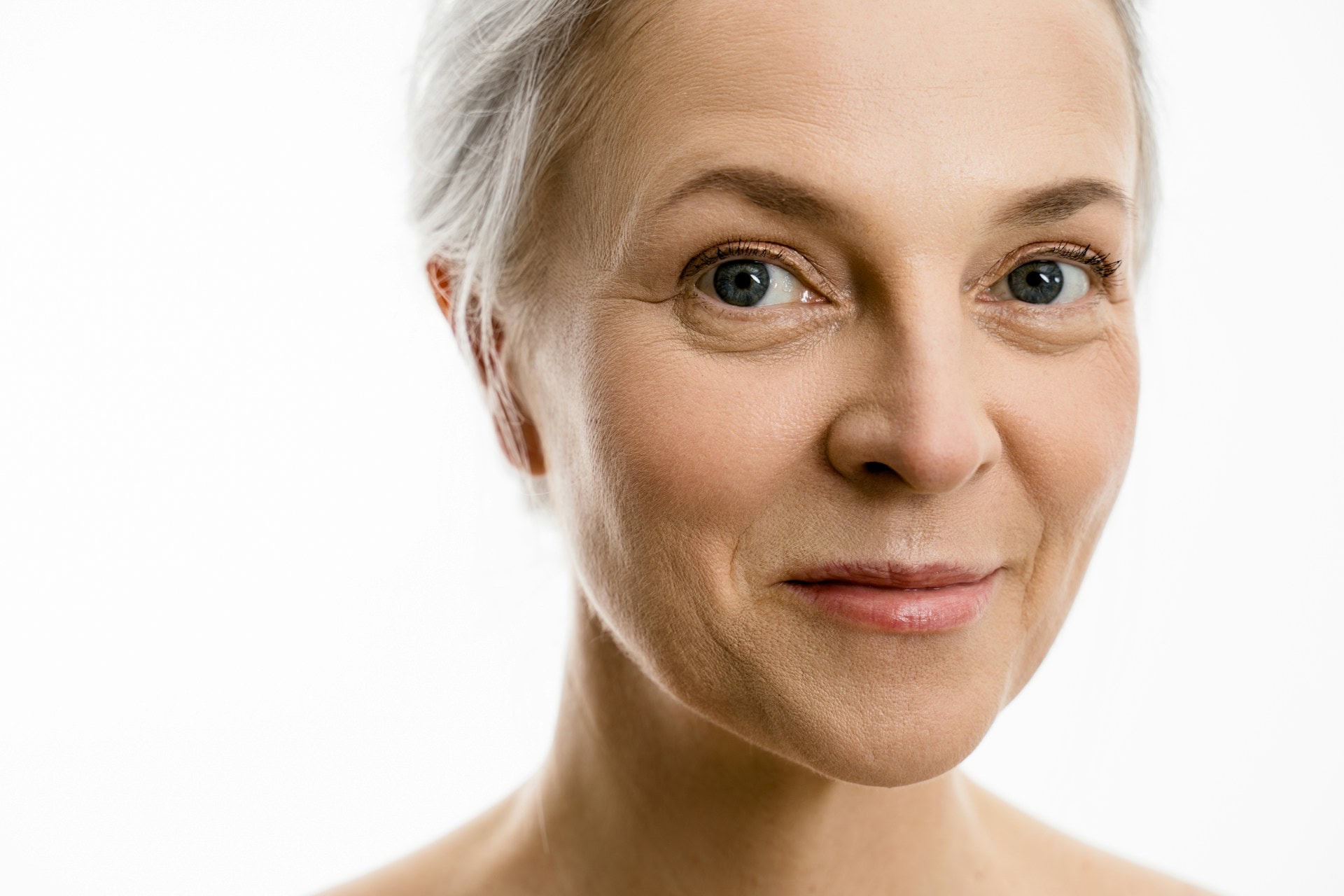 Facelifts