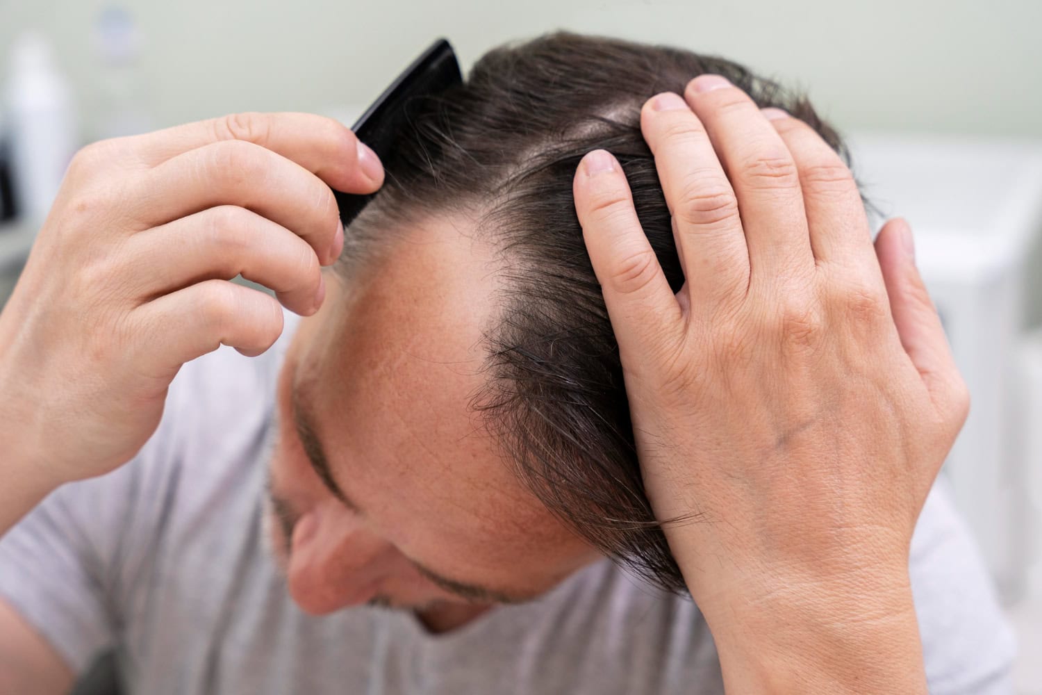 thinning hair