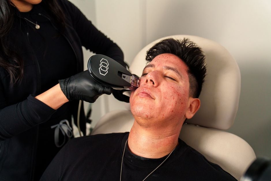 Non-Invasive Hair Rejuvenation in Lake Jackson: Your Best Options