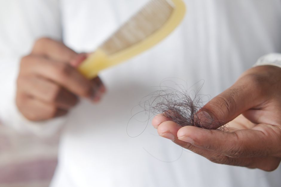 Hair Loss Treatment in Lake Jackson, Texas: Your Guide to FoLix